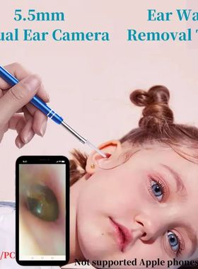 Visual Otoscope for Android/PC Ear Picker 5.5mm Endoscope Ca