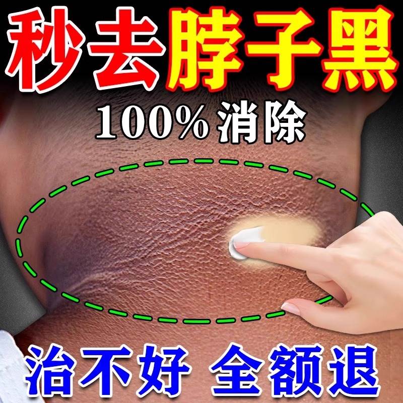脖子黑色素去除去黑美白神器皮肤黑沉淀变白黑棘皮药膏颈部美白霜