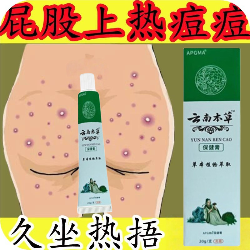 屁股上长痘痘久坐湿热起热疹疙瘩痒坐板疮臀部湿痒疹屁股疮红肿药