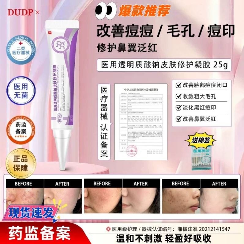 Dudp医用凝胶Dudp小紫管dp凝胶透明质酸钠细致毛孔祛痘印痘痘闭口
