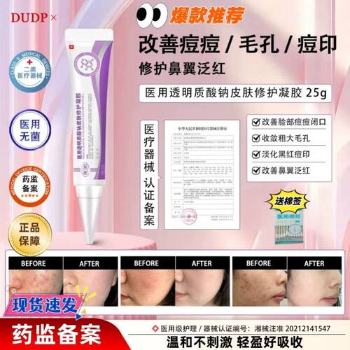 Dudp医用透明质酸钠Dudp小紫管dp凝胶细致毛孔痘印痘痘闭口修护正