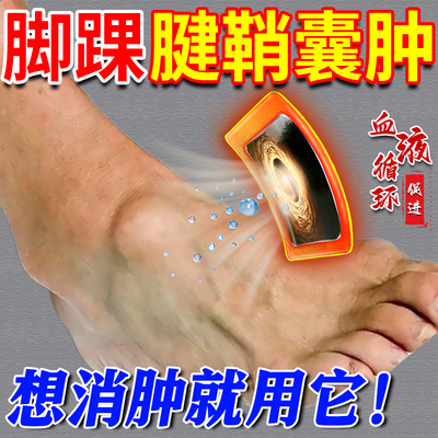 脚踝腱鞘囊肿贴鼓包热敷消除专用膏药贴疼痛脚背腱鞘炎KD