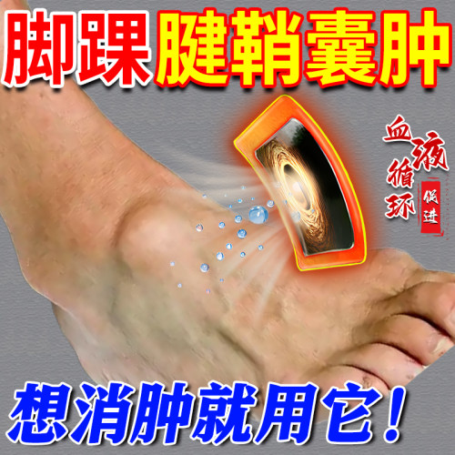 脚踝腱鞘囊肿贴鼓包消除热敷专用膏药贴疼痛脚背腱鞘炎辅助治疗KD