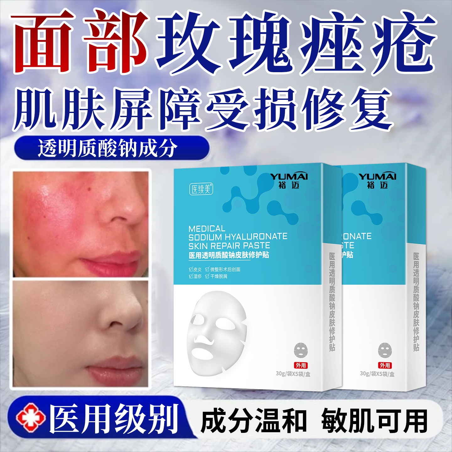 皮肤玫瑰痤疮修复肌肤屏障受损修护械准字号透明质酸钠医面膜用VV,医疗器械,伤口敷料,淘宝优惠券,粉丝福利购,淘宝优惠卷