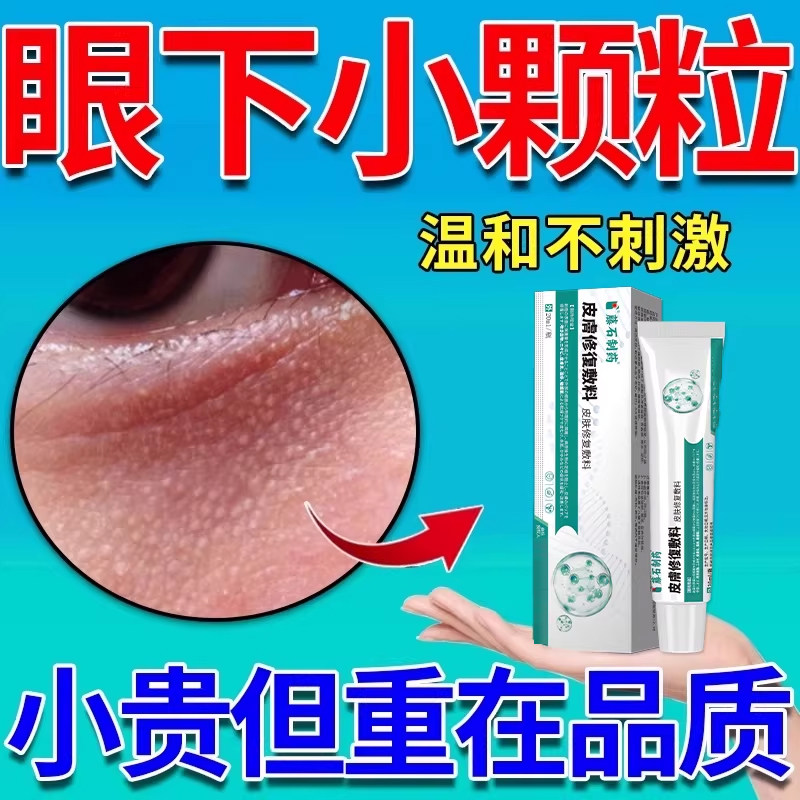 眼下毛周角化脸部眼睛下面小颗粒去眼周颗粒鸡皮肤疙瘩毛囊角化KV