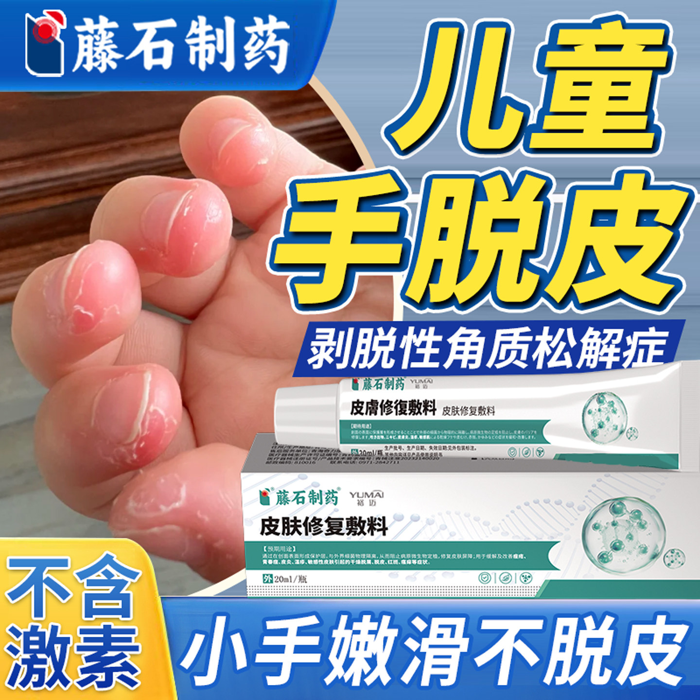 儿童手指脱皮小孩手严重专用真菌蜕皮干燥起皮剥脱性角质松懈症KD