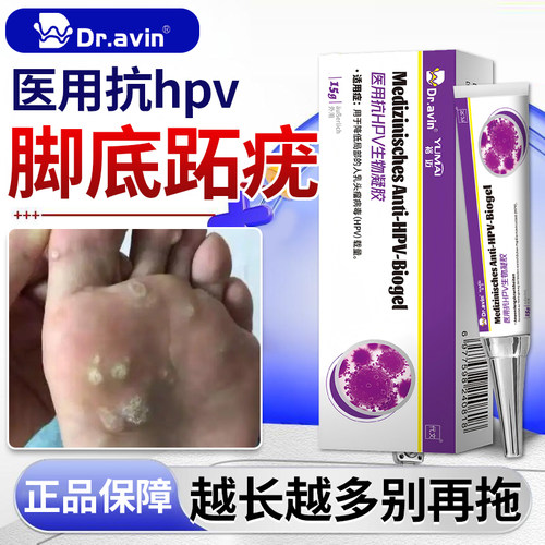 跖疣专用膏去足部脚底根上长趾疣去除病毒疣连根拔根趾疣除鸡眼KD