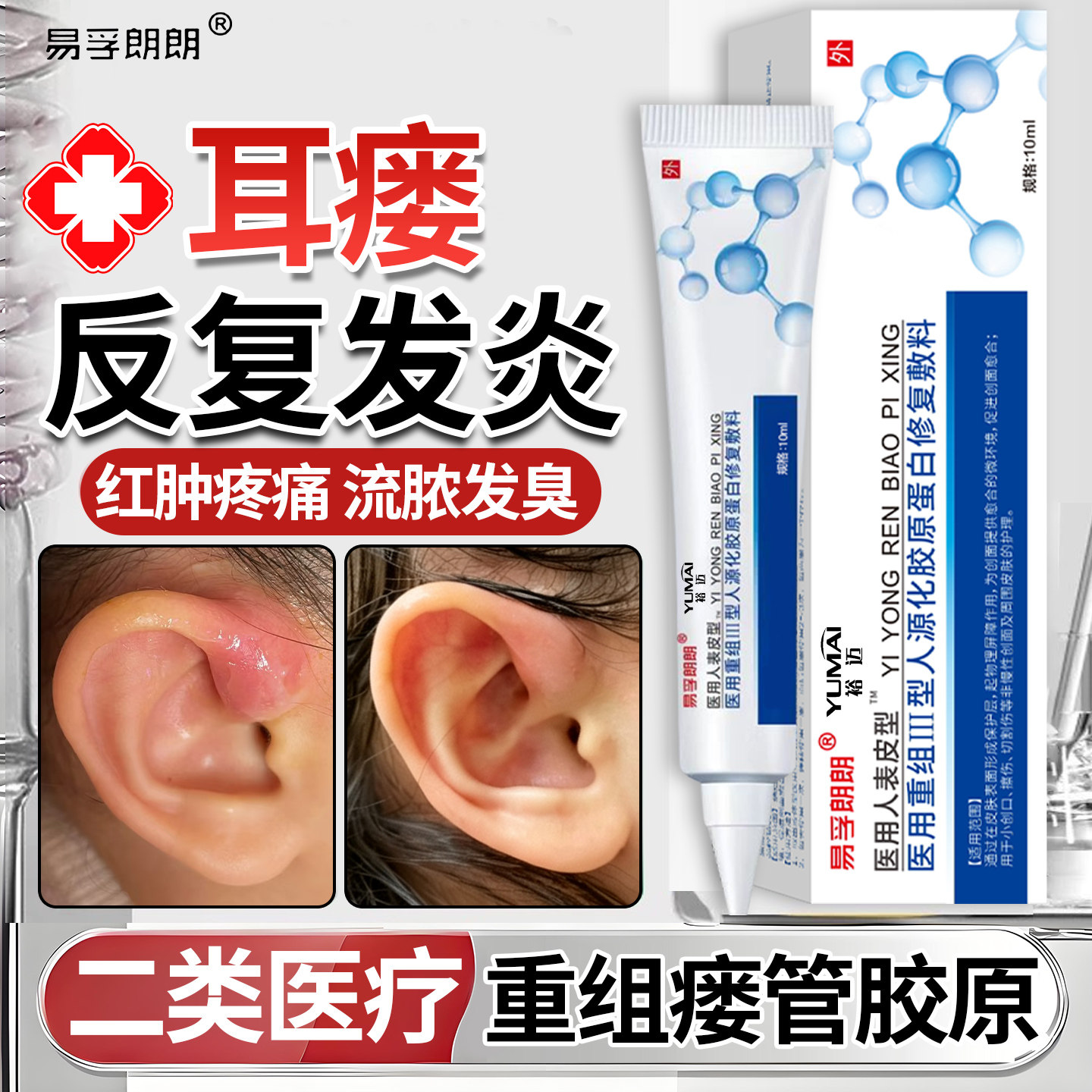 耳前瘘管药膏发炎儿童耳仓发肿消炎清理工具耳朵仓先天性防水贴QY