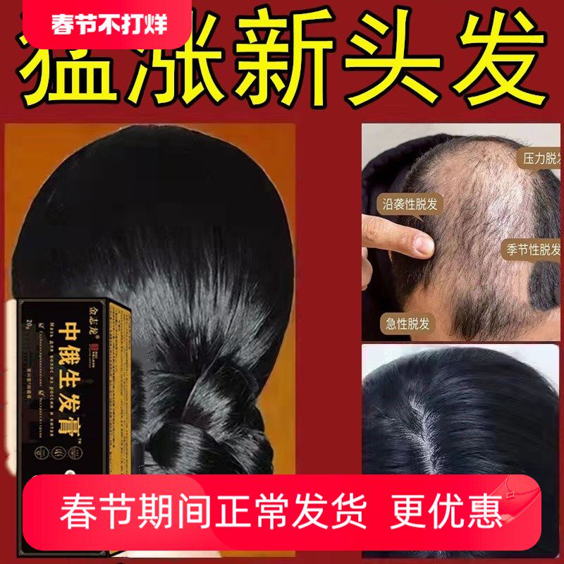 【中俄生发膏】防脱育发液头发快速生长生发液秃顶专用滋养修复