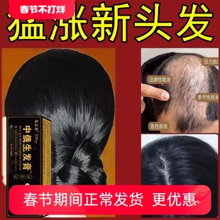 【中俄生发膏】防脱育发液头发快速生长生发液秃顶专用滋养修复