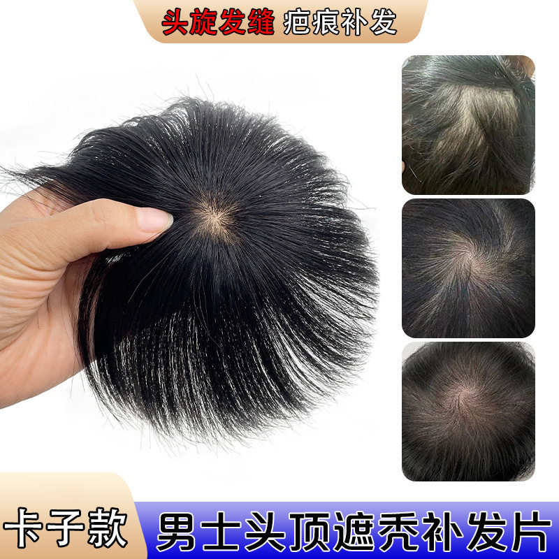 男士轻薄头顶补发块头旋后脑勺