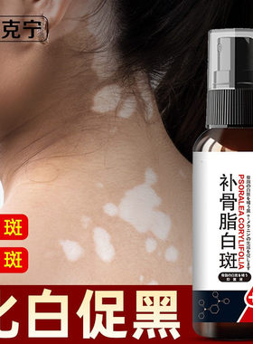祛除白点风白癜净白斑疯丸去白驳风白颠花斑白斑癣白色糠疹修复