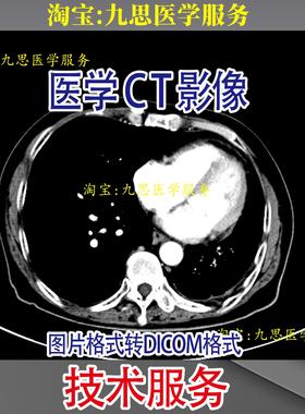 CT医学影像 dicom dcm文件格式转图片 影像科CT DR MRI 无损转换