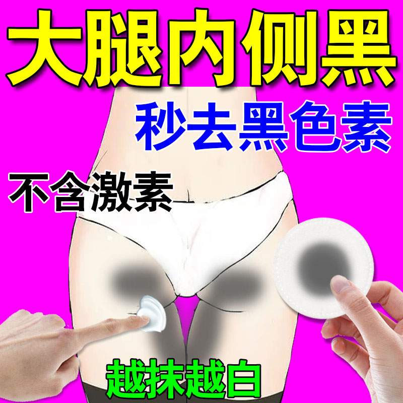 大腿内侧黑黑屁股去黑坐印药膏