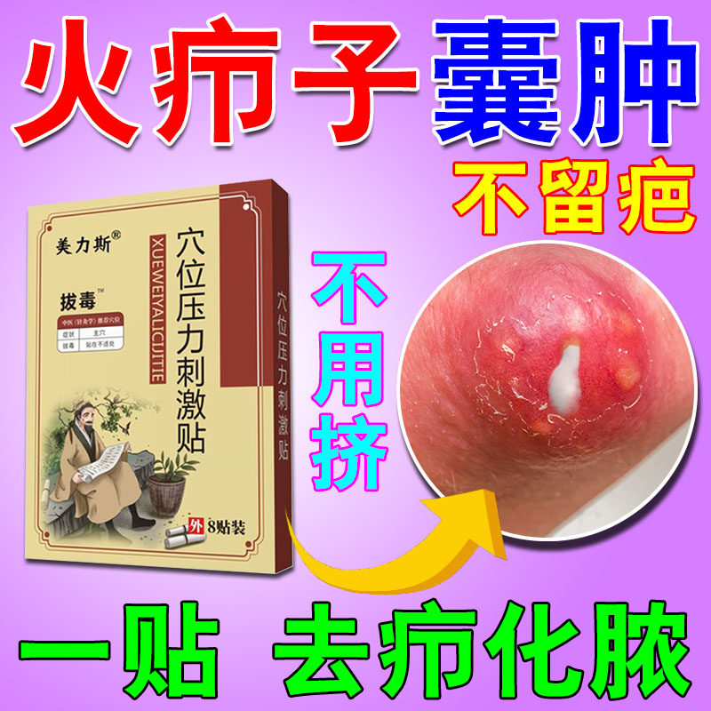 疖肿拔毒膏皮脂腺囊肿膏药贴去除火疖子粉瘤屁股上长痘痘坐疮膏药