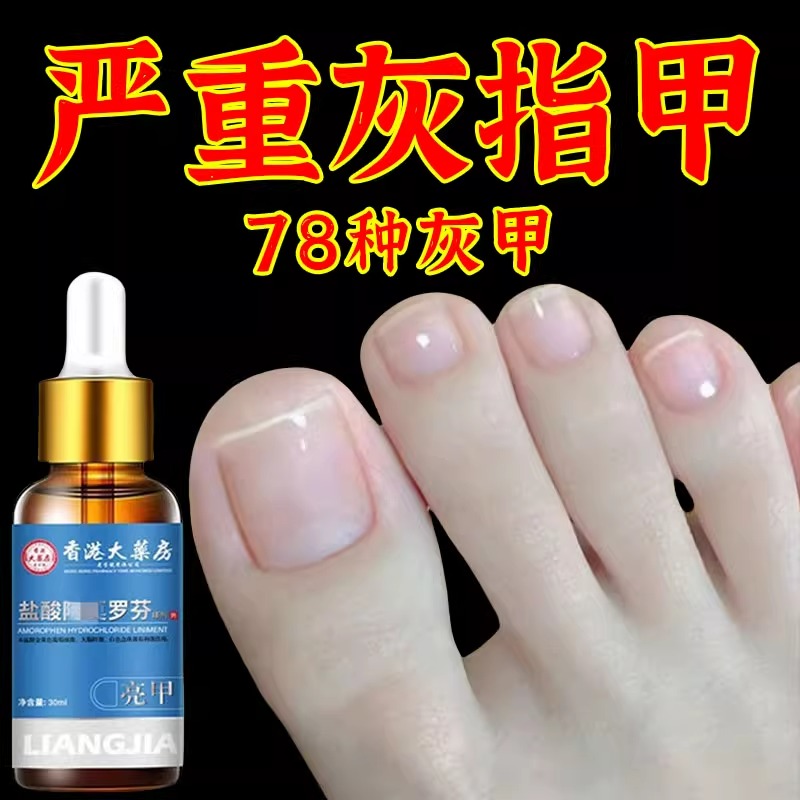 盐酸灰甲阿莫罗芬擦剂正品旗舰店洛芬擦剂乳膏除增厚灰指净脱甲膏