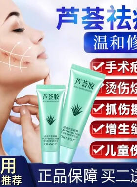 芦荟胶去疤痕祛疤膏修复儿童男女药房凝胶官方正品旗舰店