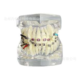 M3005 3矫正牙齿模型透明色正畸模型牙齿矫正模型