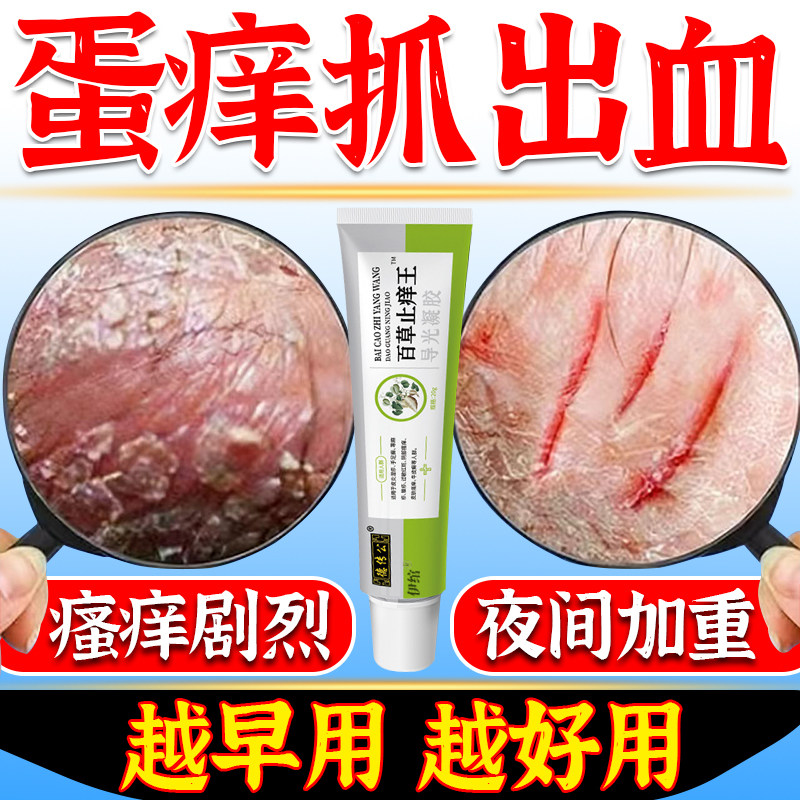 阴囊瘙痒湿疹私处睾丸痒男人下面潮湿蛋蛋痒真菌感染