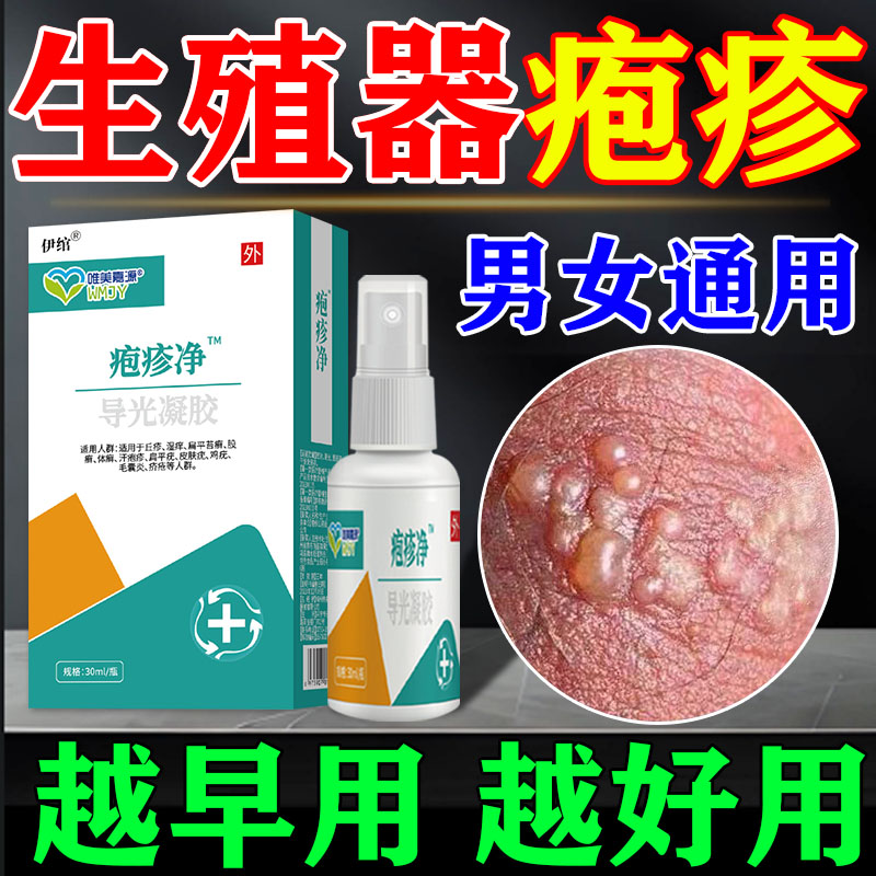 生殖器疱疹净断喷雾克星瘙痒红肿