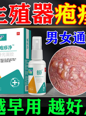 生殖器疱疹断hsv根药男女下体私处喷剂瘙痒疼痛性病梅毒外用药膏