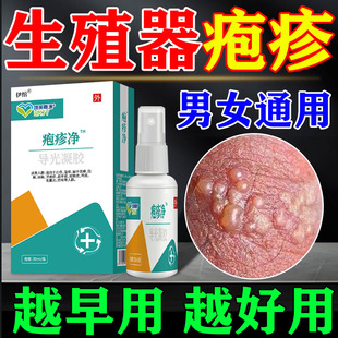 生殖器疱疹断hsv根药男女下体私处喷剂瘙痒疼痛性病梅毒外用药膏