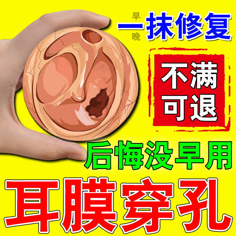 耳膜穿孔修复液中耳炎药耳鸣膏外耳道红肿流脓疼烂耳闷听不清滴液