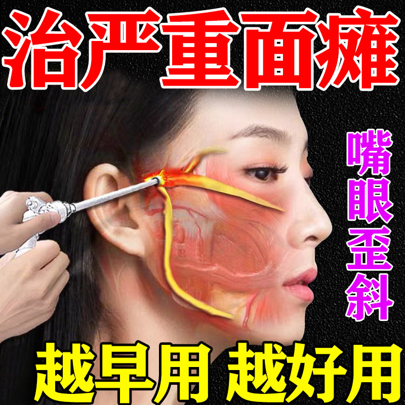 面瘫僵硬麻木贴面瘫后遗症热敷