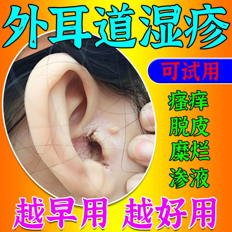 耳朵外耳道湿疹止痒去真菌感染