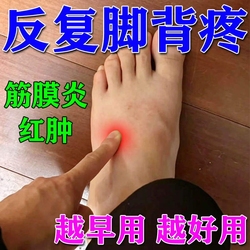 脚背疼痛贴膏筋膜炎红肿刺痛