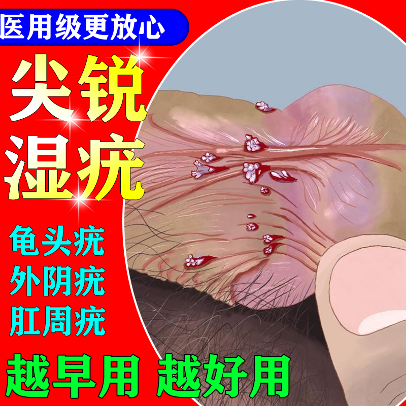 尖锐湿疣的药膏男女性私处生殖器去疣用专膏根湿疣克星鬼臼毒素膏