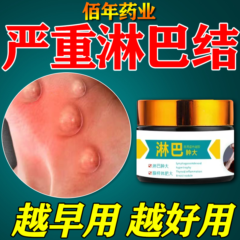 淋巴结肿大散结贴膏去结节用专膏