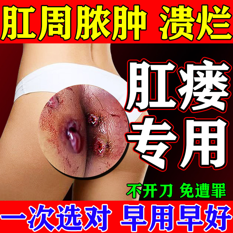 【早用早好】肛瘘肛周脓肿消瘘膏