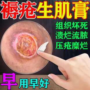去腐生肌】褥疮效特药膏老人臀部外用伤口消炎杀菌愈合促进长肉膏