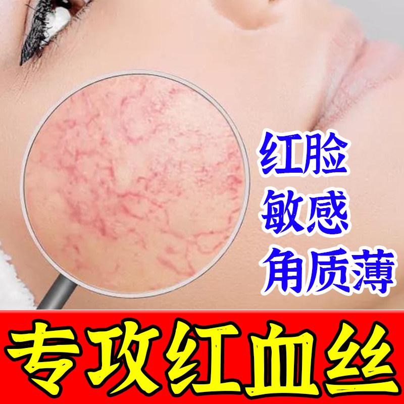 去红血丝修复改善脸部泛红敏敏感