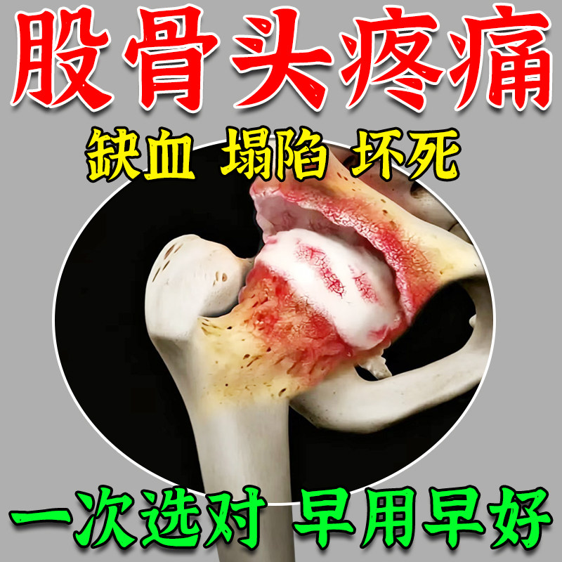 早用早好】股骨头坏死用专膏药贴