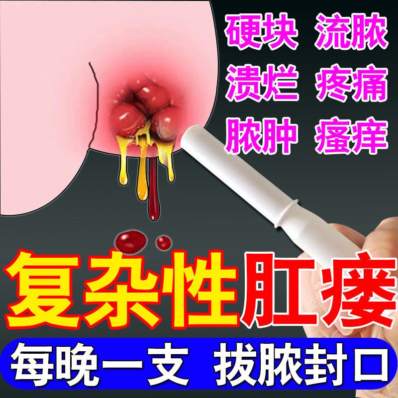 肛瘘克星肛周脓肿效特药物肛裂疼痛流脓拔脓愈合封口膏肛窦炎的药