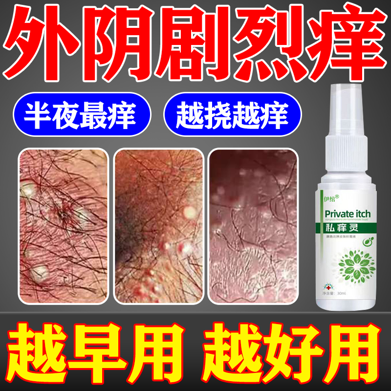 可试用】女性私处外阴瘙痒止痒膏
