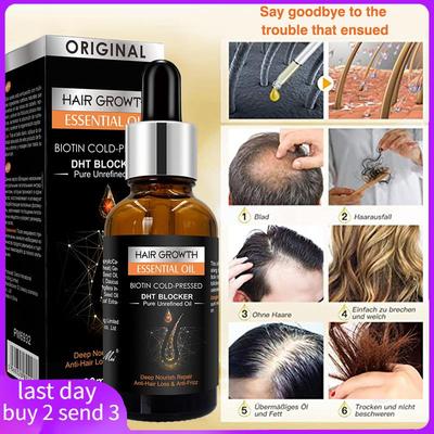 HairgrowthkScalpCen头