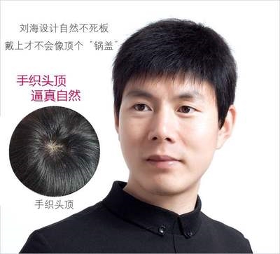 热卖头套秃头秃顶织发真发顶男士头发p蓬松假发片男头顶补发块寸