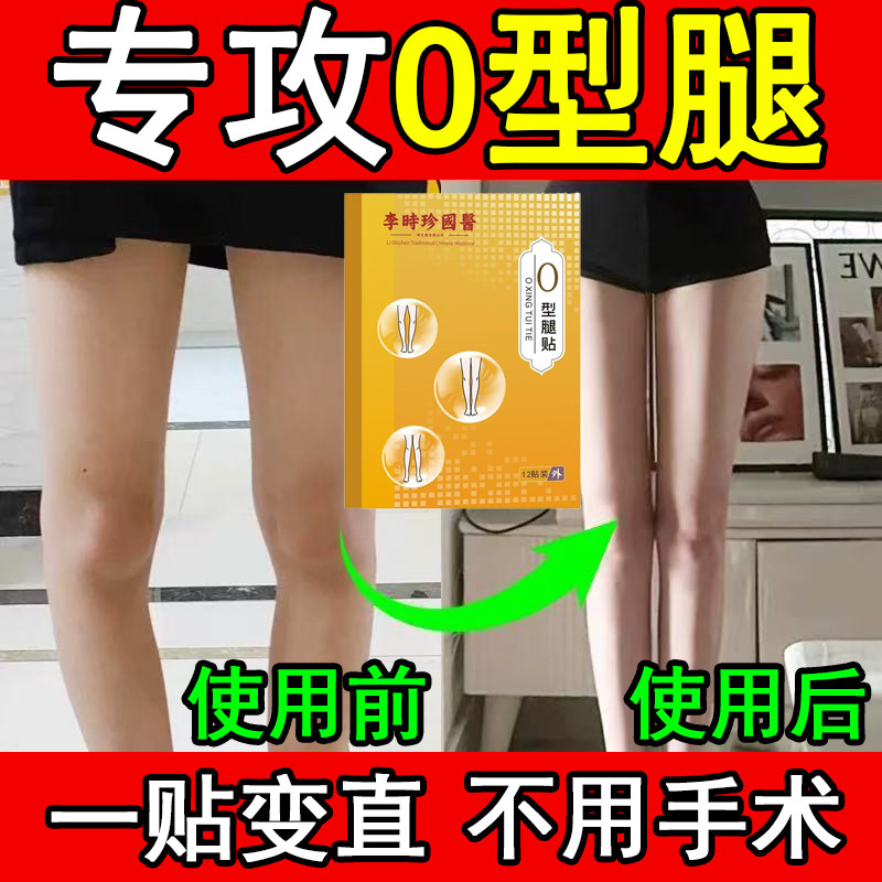 O型腿矫正直腿神器改善小腿外翻罗圈腿xo型内八腿专用矫正膏药贴,个人护理/保健/按摩器材,矫姿用品,淘宝优惠券,粉丝福利购,淘宝优惠卷