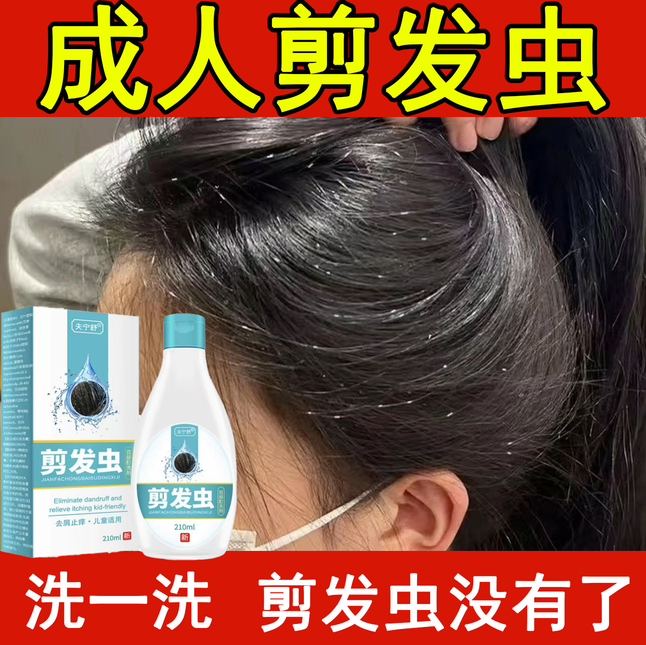 去剪发虫洗发水小女孩除头螨卷发虫头发上小白点洗发水头痒洗发露