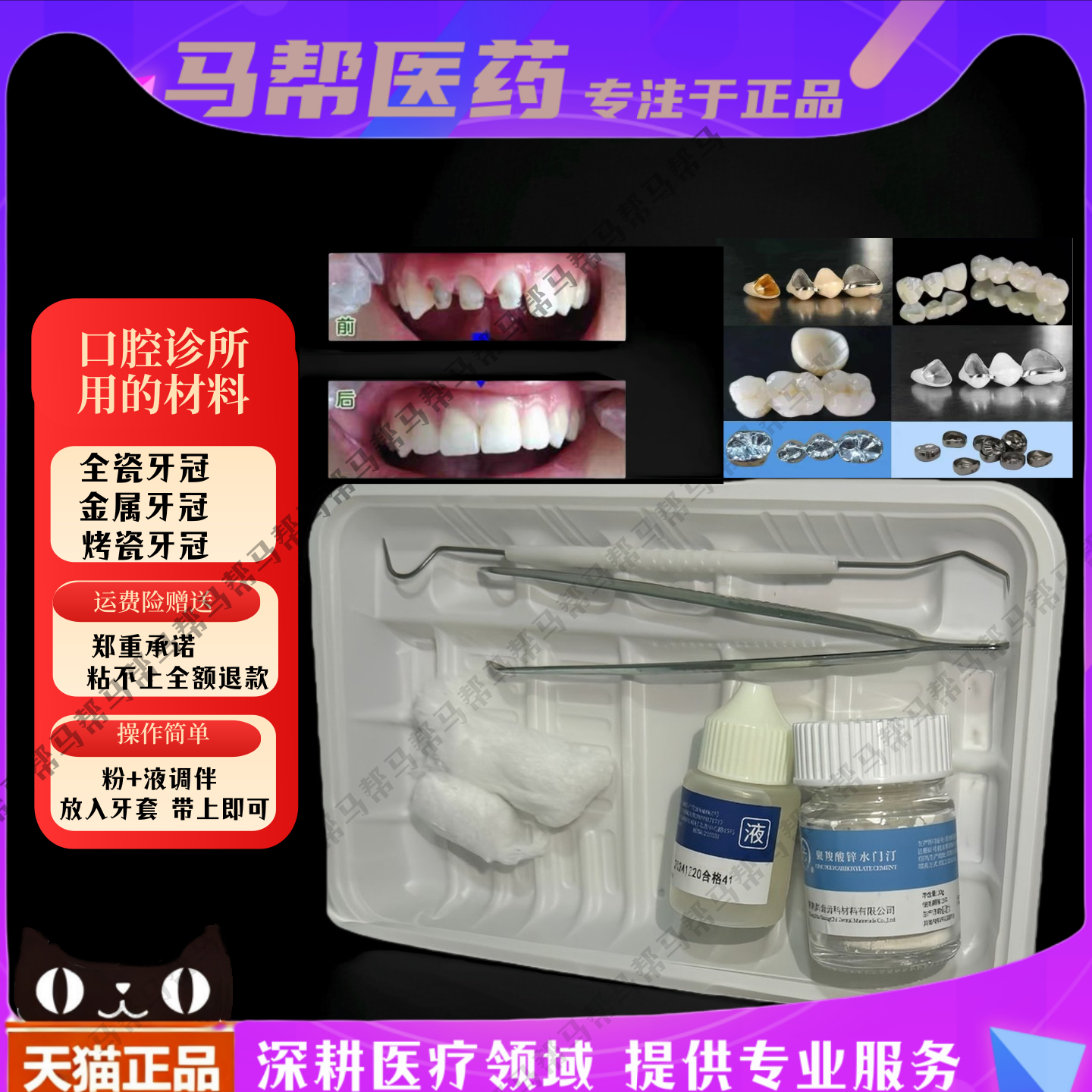 牙科粘结牙冠牙科胶水粘假牙材料牙套胶自己粘假牙胶