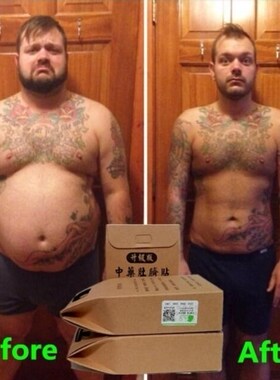 Chinese Medicine Slimming Patch Face Lift Lose Weight Stron