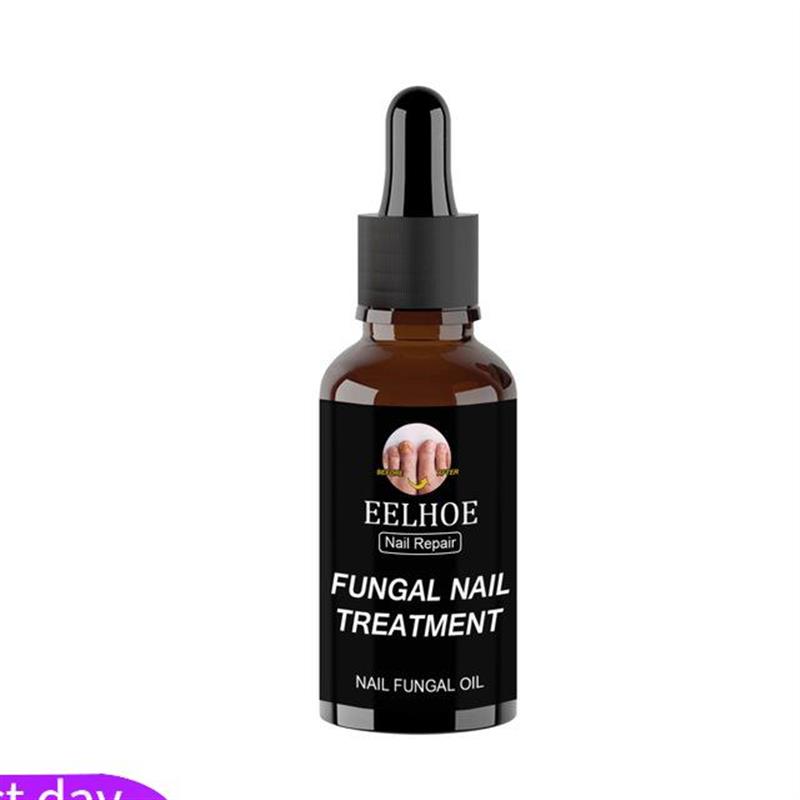 30ml Fungal Nail Repair Essence Feet CareTreatment Foot Toe