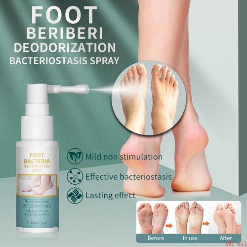 foot bacteria  bacteriostasis spray deodorization remove
