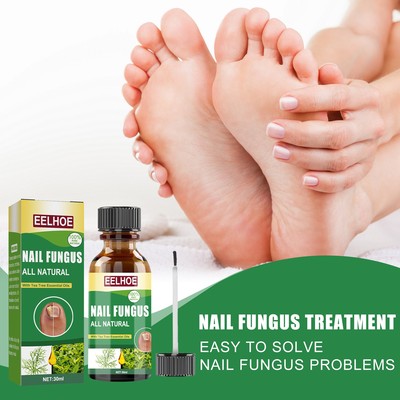 Nail Fungus Treatment Essence Serum Care Hand and Foot Care