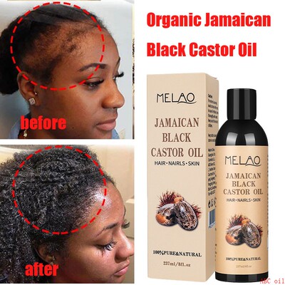 Jamaican Organic Black Castor Oil Hair Growth Scalp黑蓖麻油
