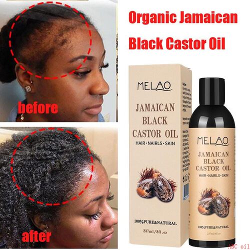 Jamaican Organic Black Castor Oil Hair Growth Scalp黑蓖麻油