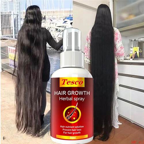 Hair Growth Serum Spray Fast Hair Growth Liquid 头发养护油